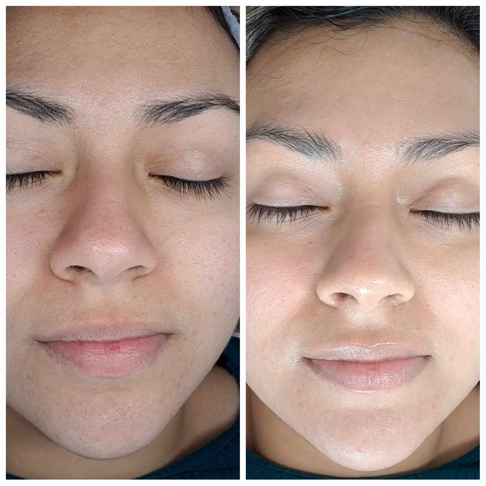 Limpieza facial personalizada en MayGlow Zaragoza