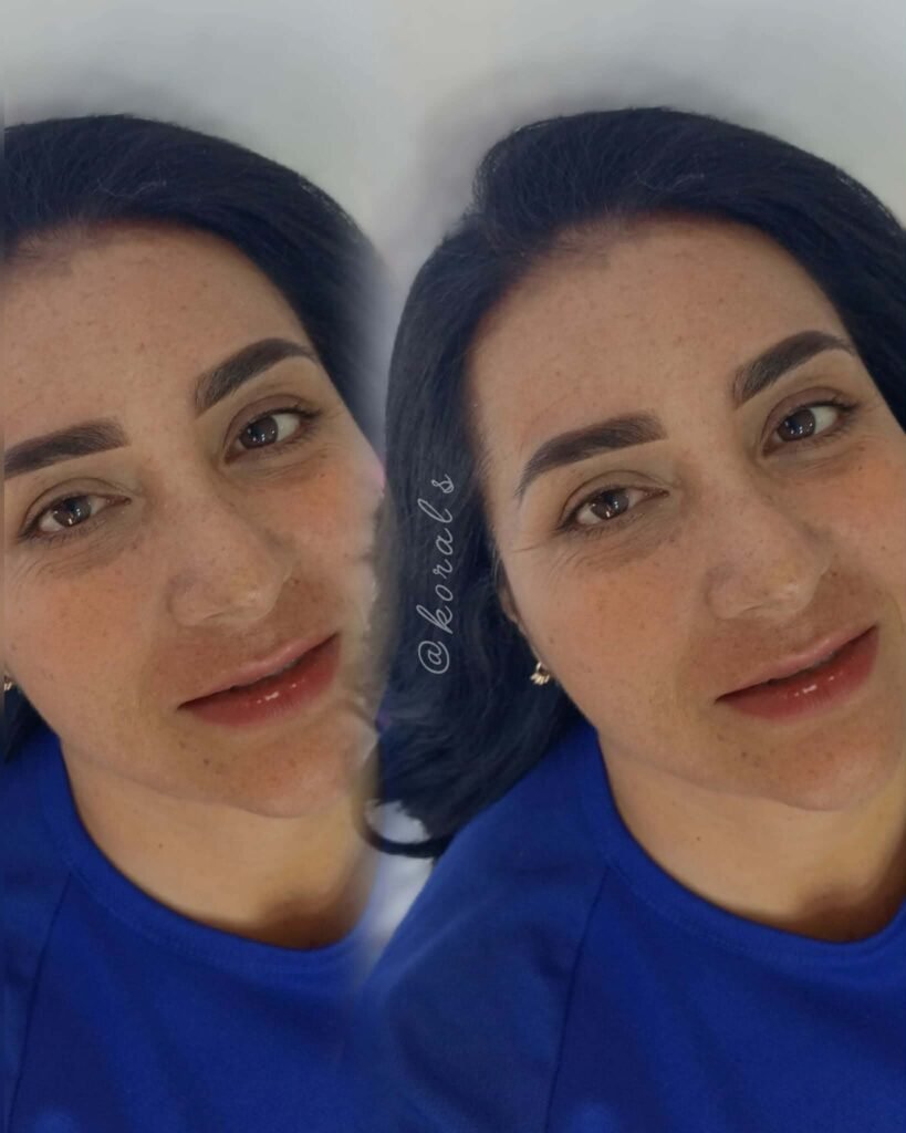 Tratamiento-estético-diseñado-para-redefinir-las-cejas Tratamiento estetico disenado para redefinir las cejas