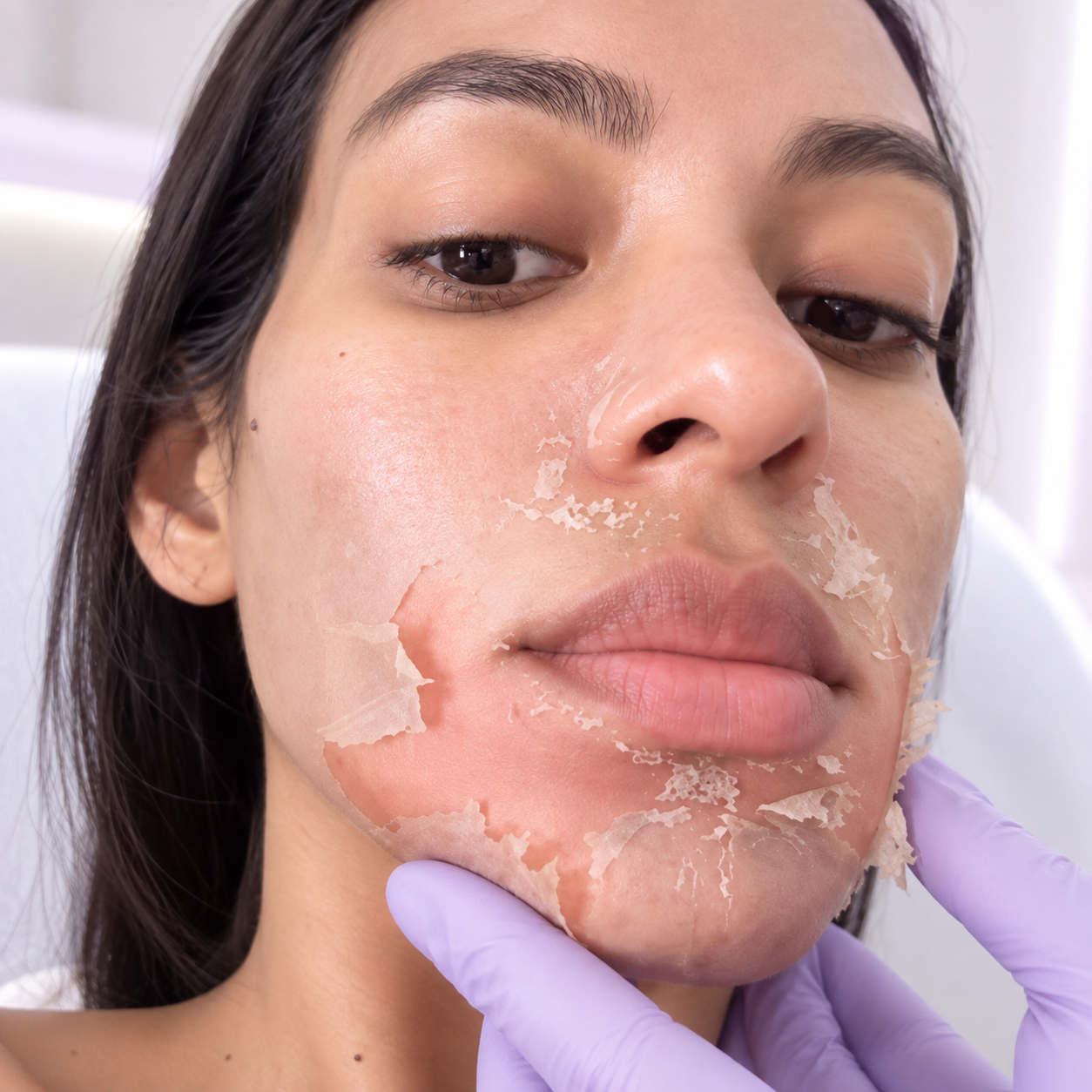 Peeling coreano de algas