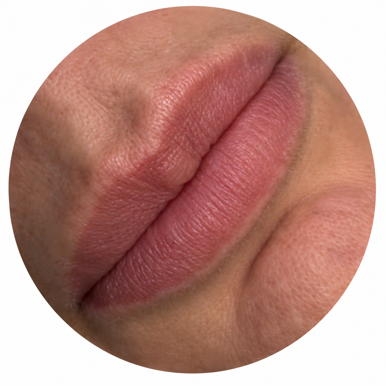 Antes del tratamiento Hydra Gloss en MayGlow