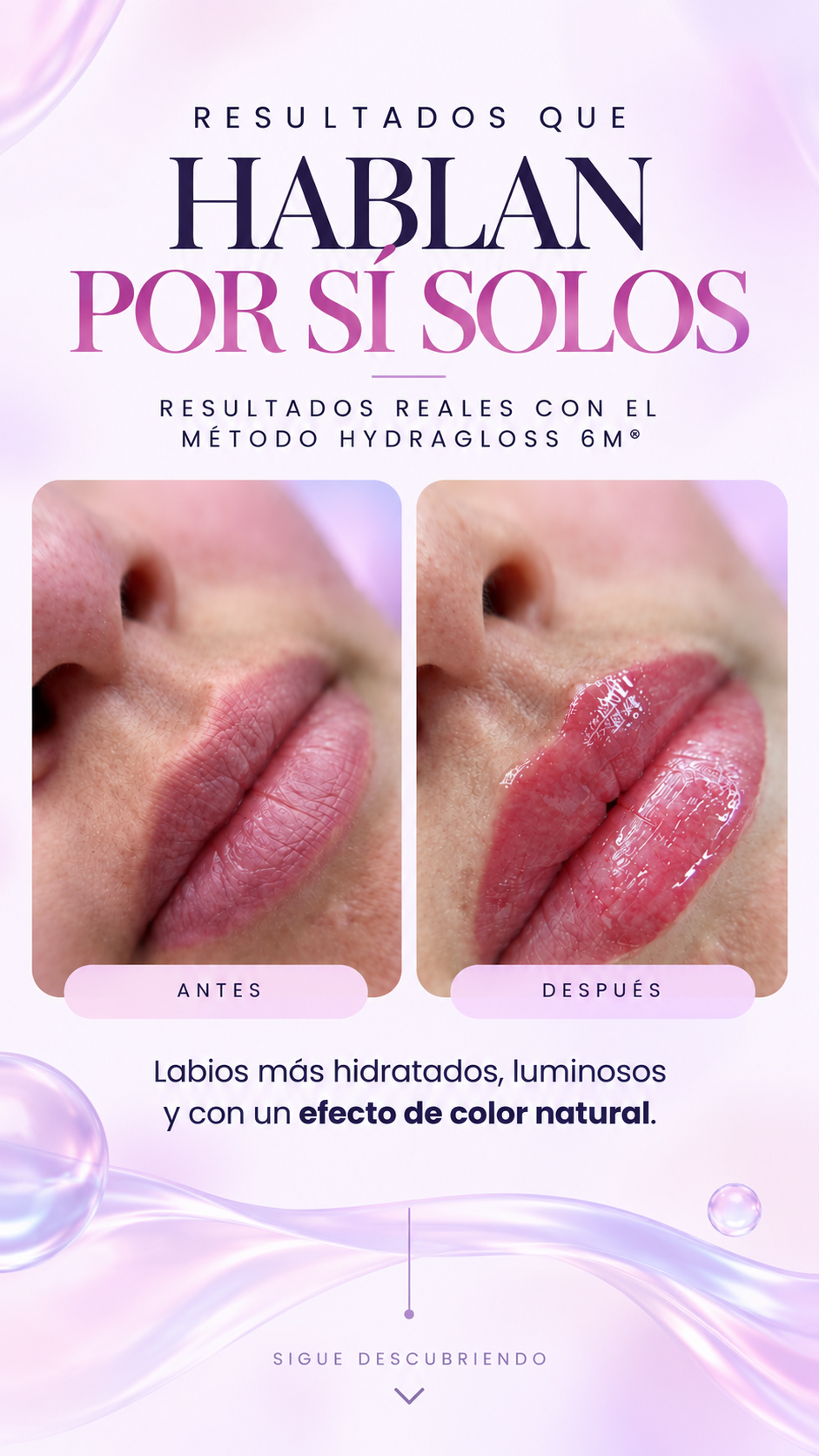 Présentation de la formation Hydragloss